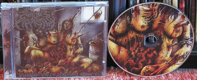 Suicide Of Disaster ‎– Evisceration Of Pregnant Abdomen