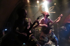Stillbirth-3