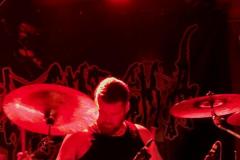 Rectal-Smegma-4