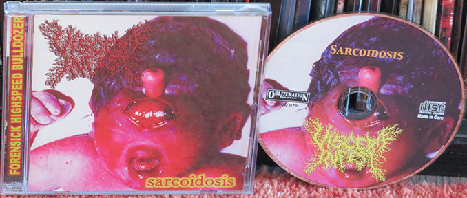 Viscera Infest ‎– Sarcoidosis